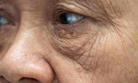 woman aging