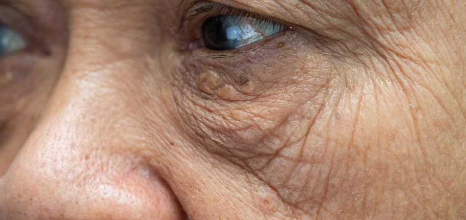 woman aging