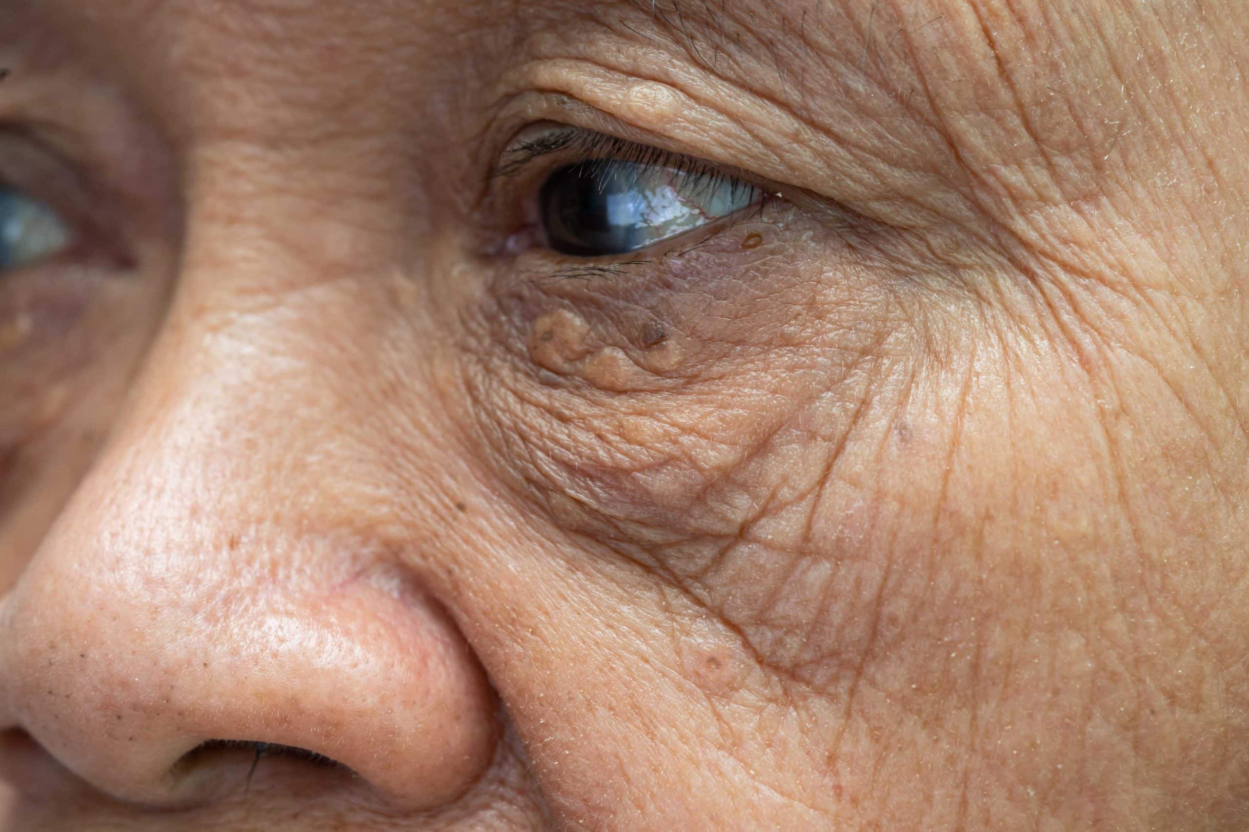 woman aging