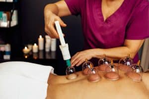 woman doing a cupping therapy on a patient